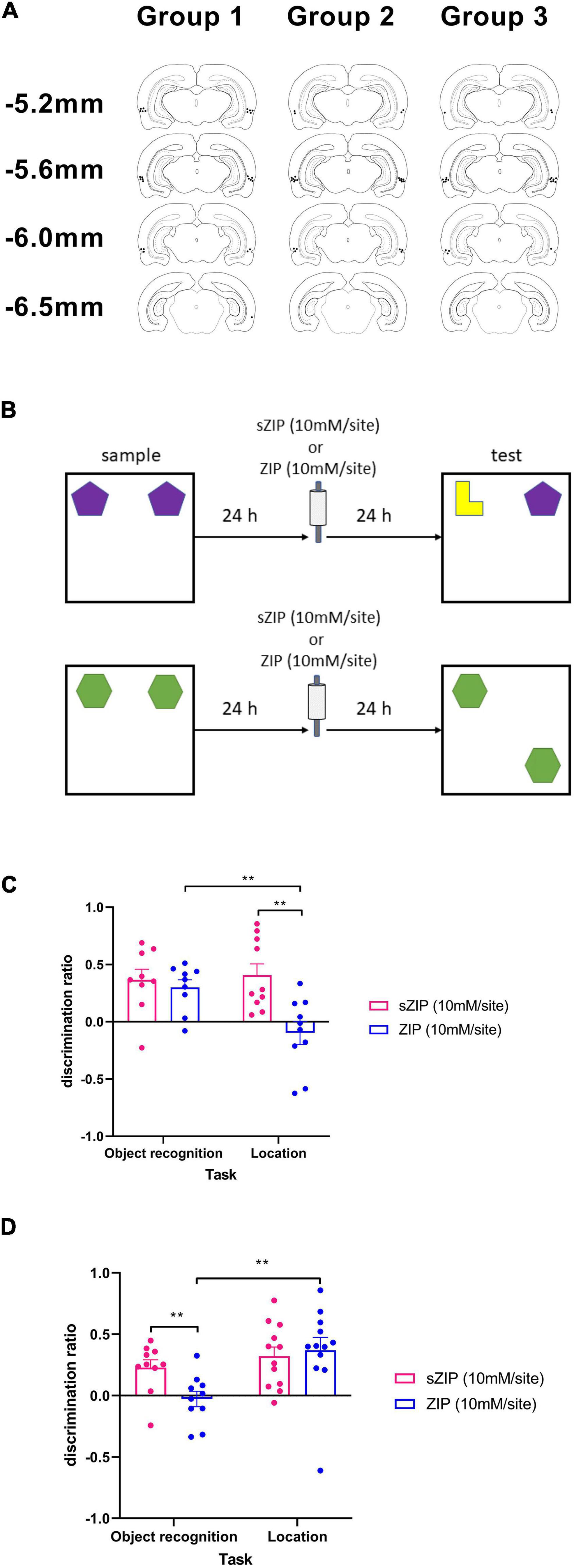 Synaptic Plasticity Learning and Memory in Perirhinal Cortex