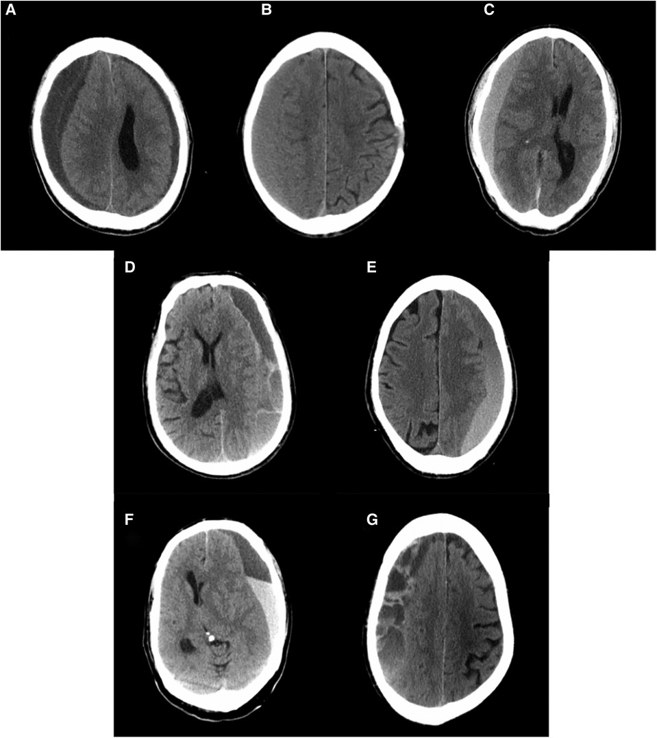 Frontiers | Peripheral blood eosinophil and classification of