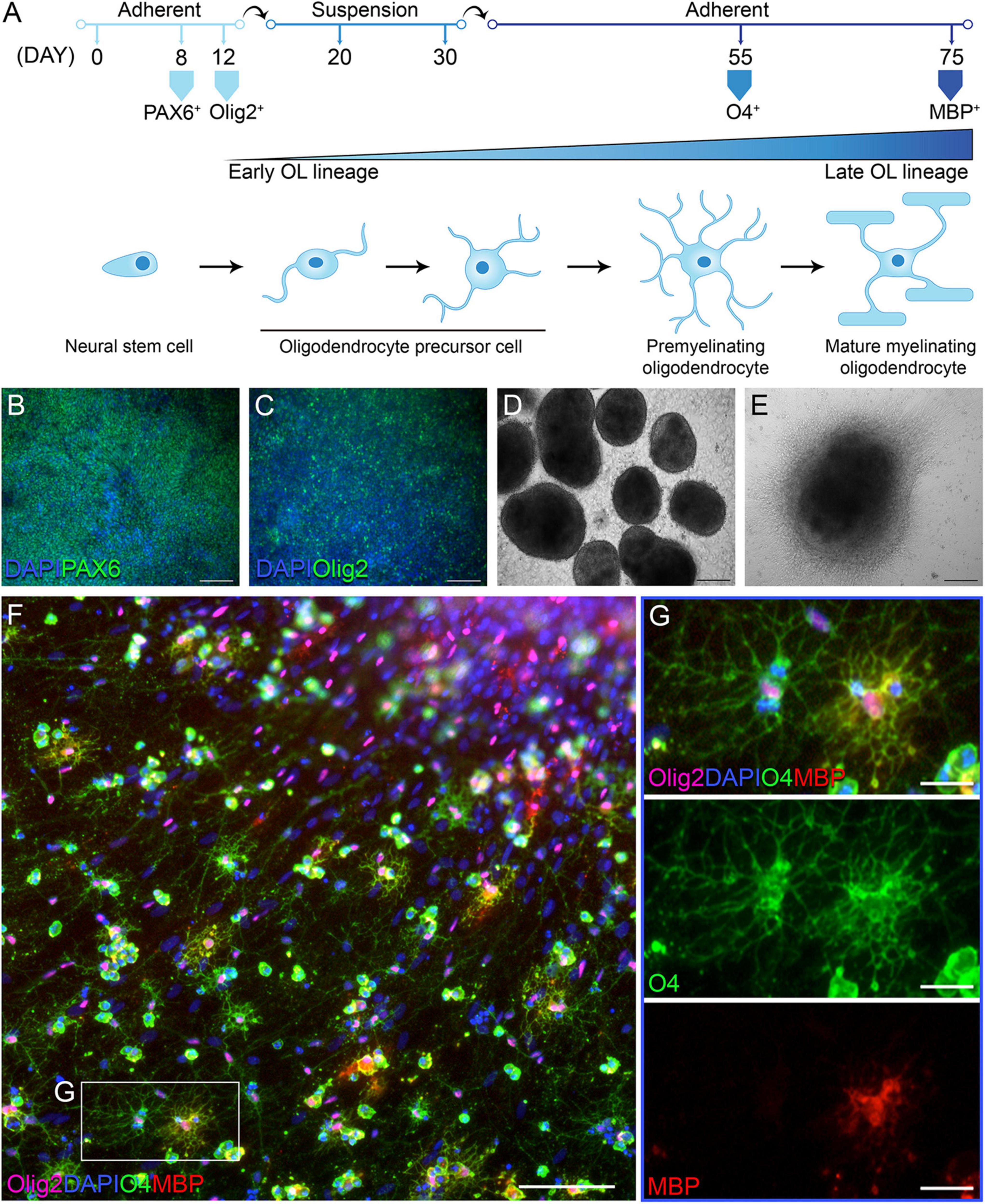 Frontiers  Therapeutic Advances in Multiple Sclerosis