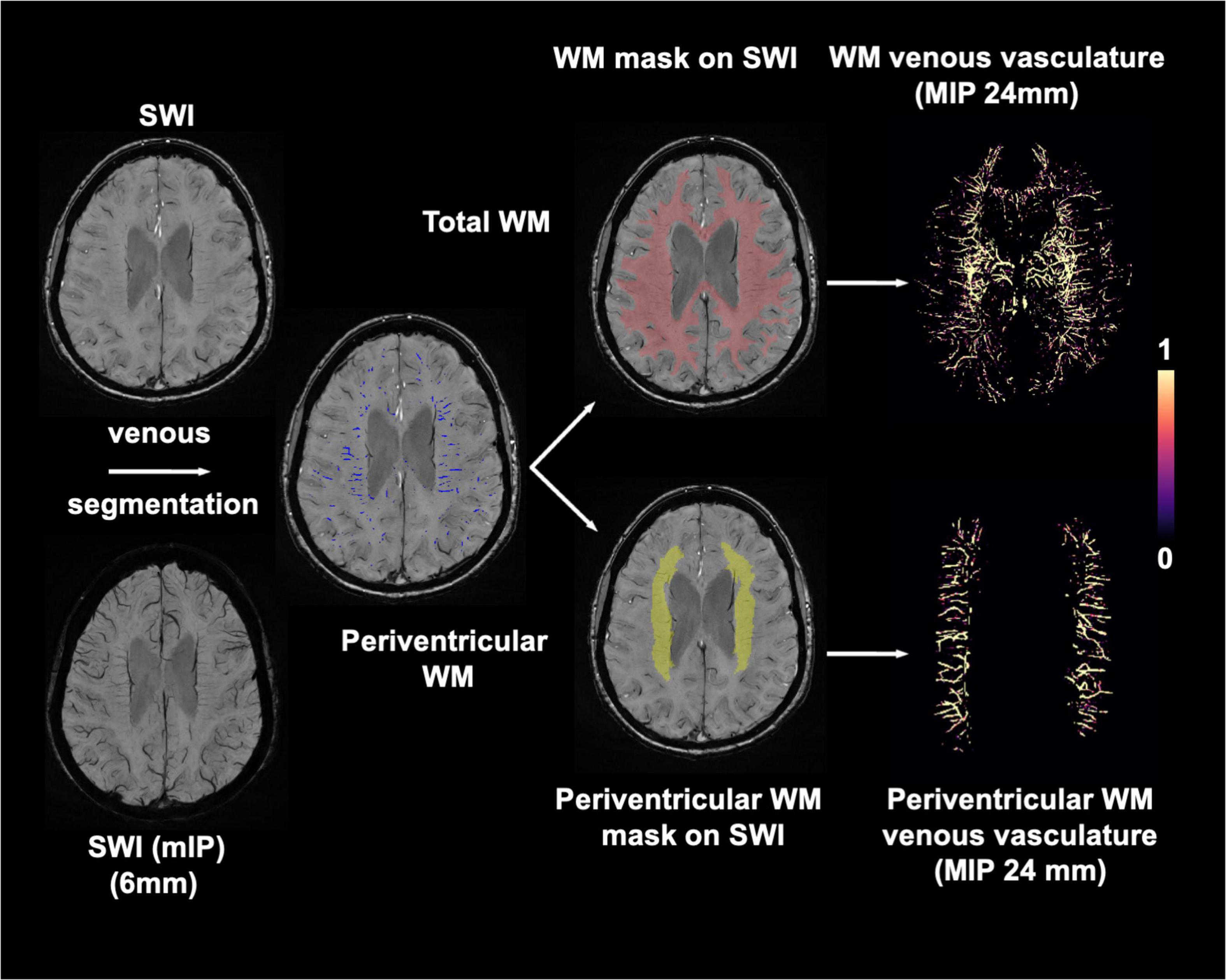 Spee-D-Mark CT Scan Skin Markers