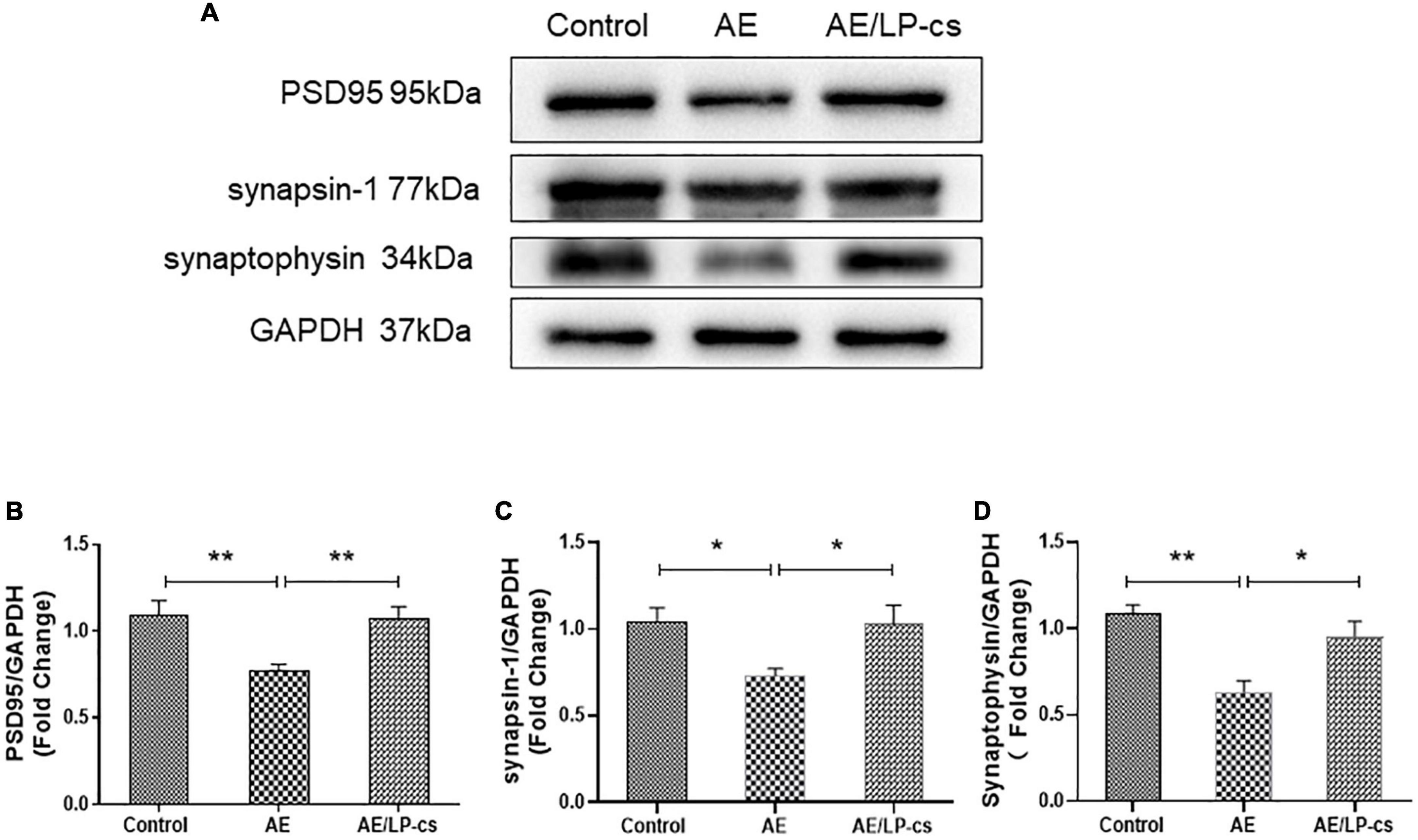 Frontiers | Lactobacillus plantarum ST-III culture