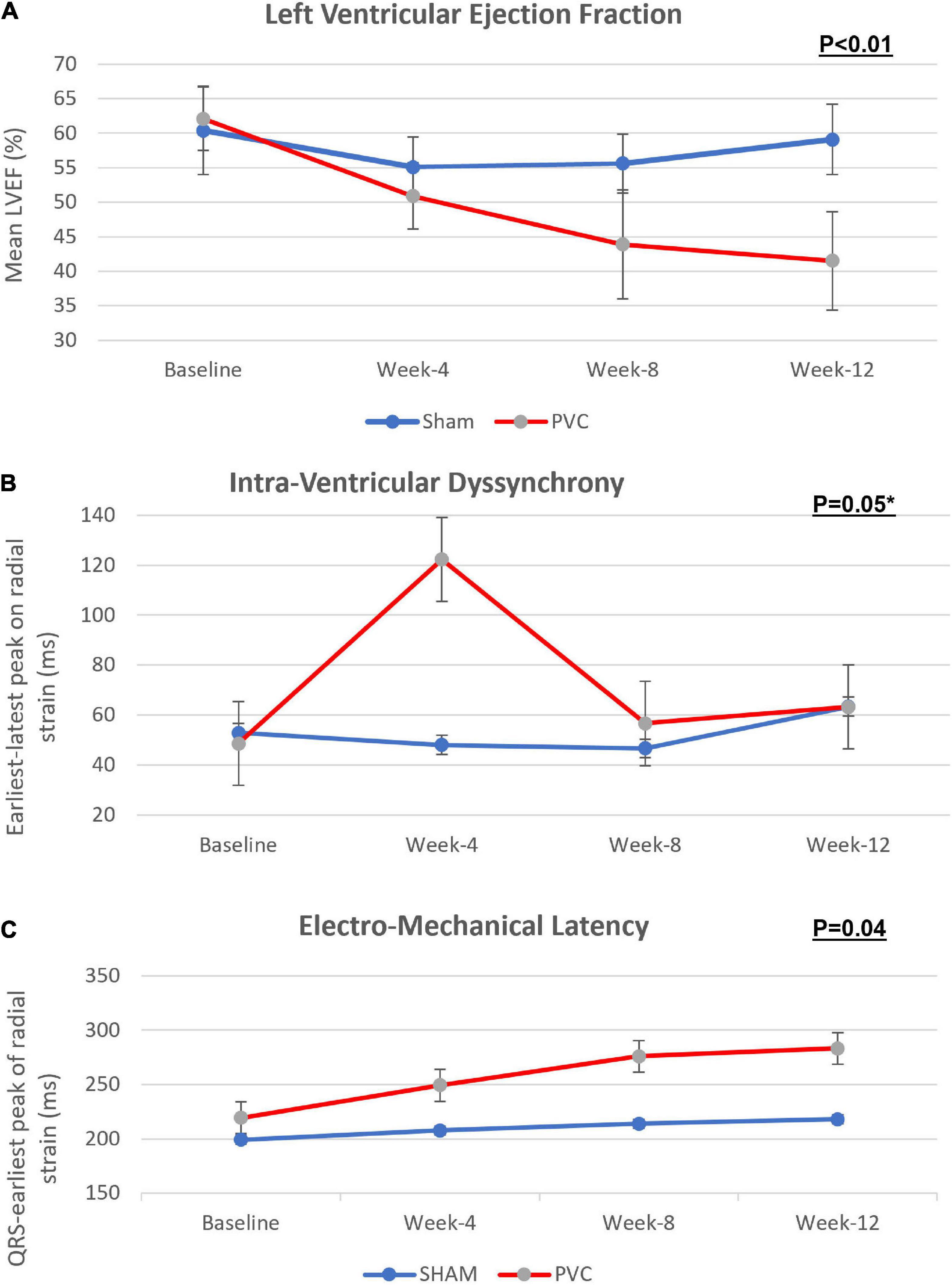 Assessment of subtle cardiac dysfunction induced by premature ventricular  contraction using two-dimensional strain echocardiography and the effects  of successful ablation