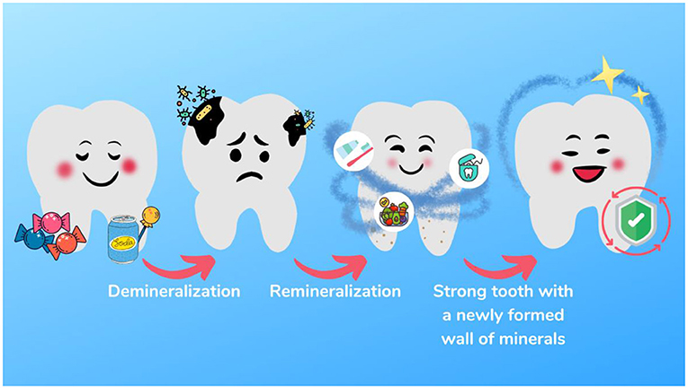 Figure 2 - The demineralization-remineralization process.