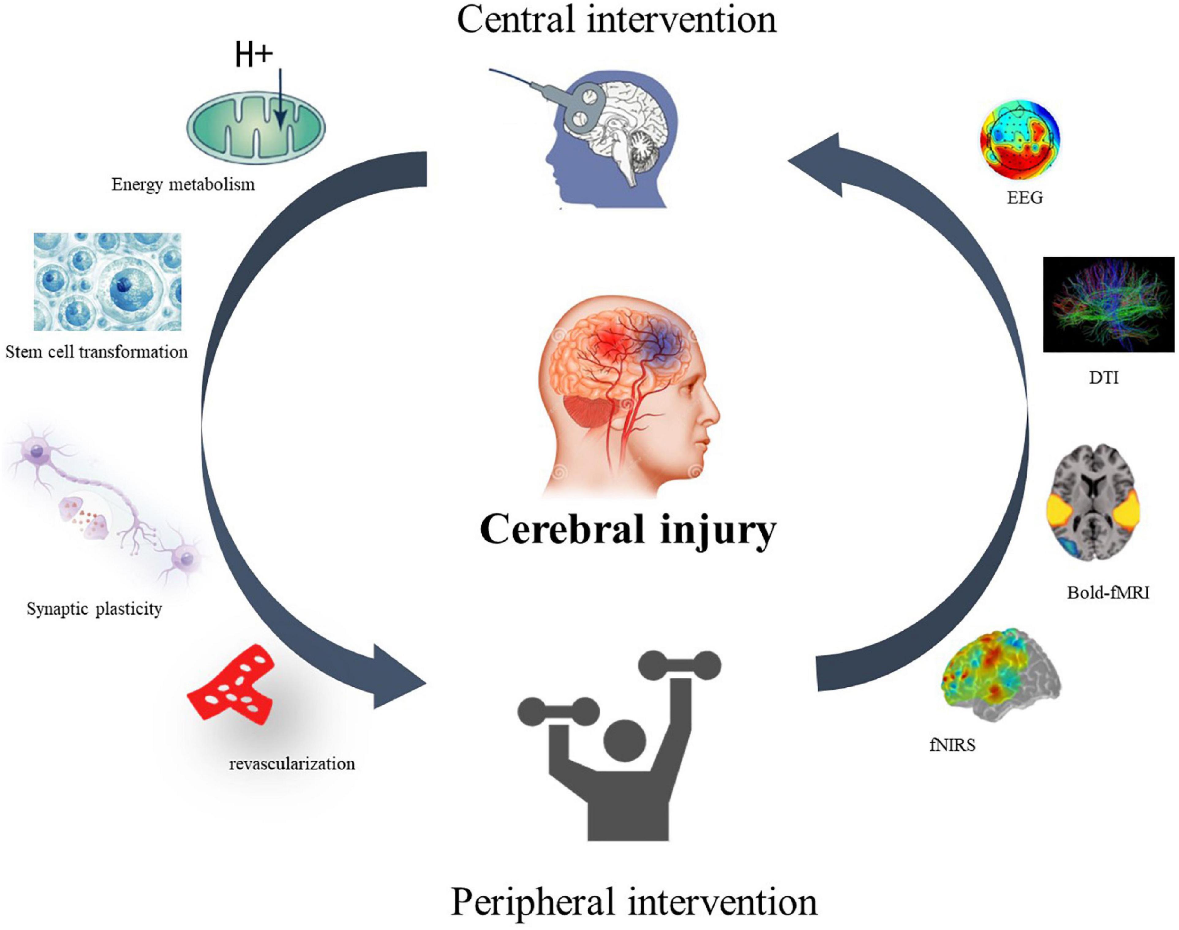 Effects of electrical muscle stimulation on cerebral blood flow, BMC  Neuroscience