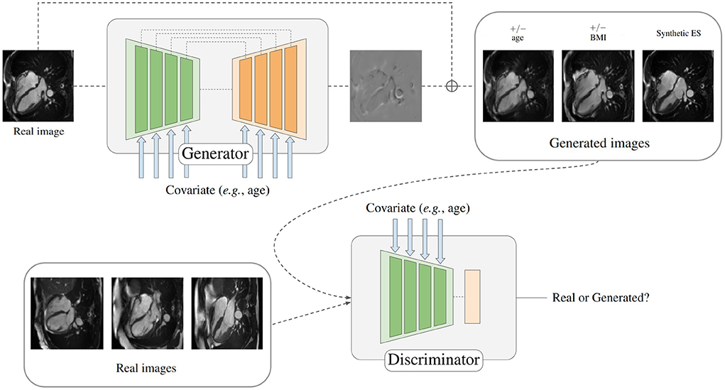faglært ebbe tidevand marmelade Frontiers | Cardiac aging synthesis from cross-sectional data with conditional  generative adversarial networks