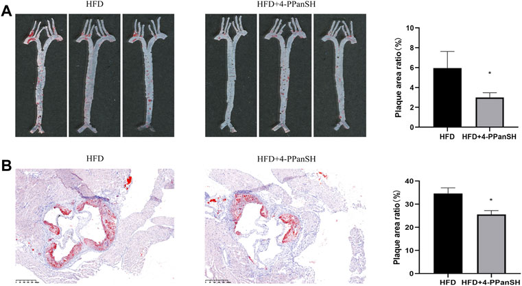 Frontiers  Characteristics and evaluation of atherosclerotic plaques: an  overview of state-of-the-art techniques