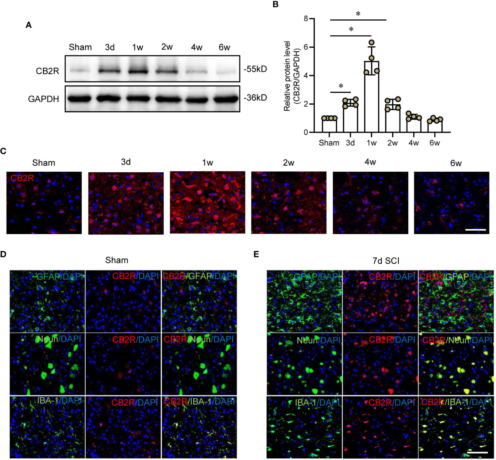 Frontiers | Cannabinoid receptor-2 attenuates neuroinflammation by 