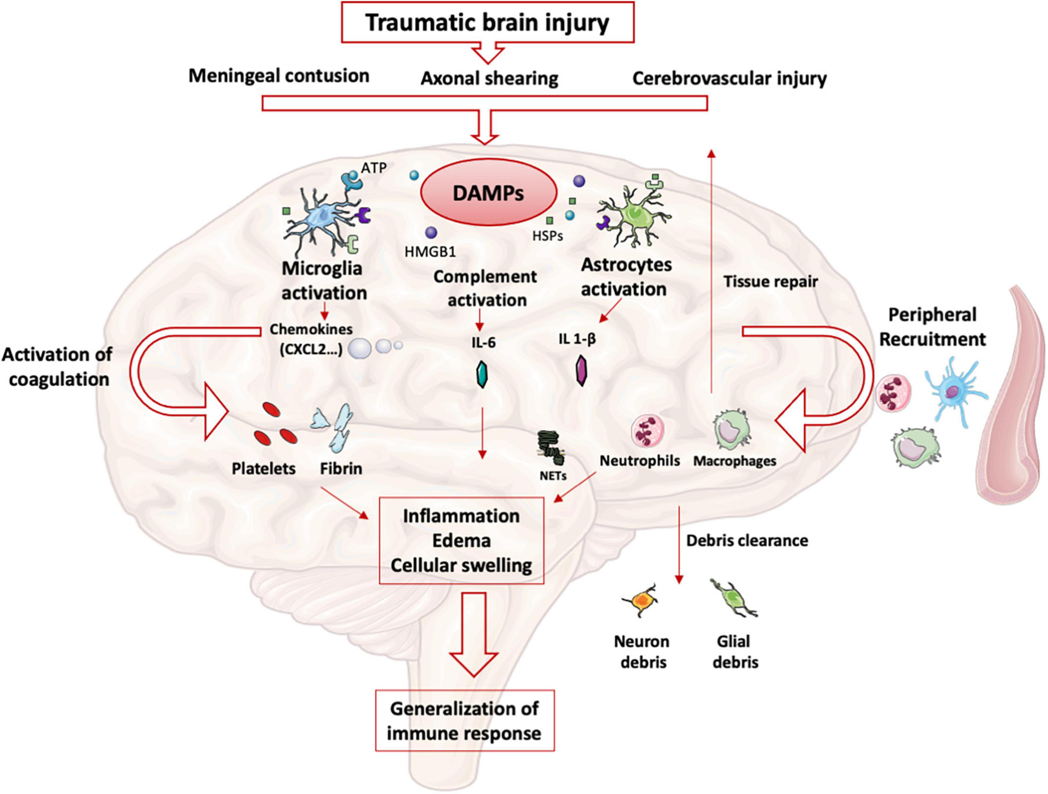 Immunomodulatory response in an experimental model of brain death