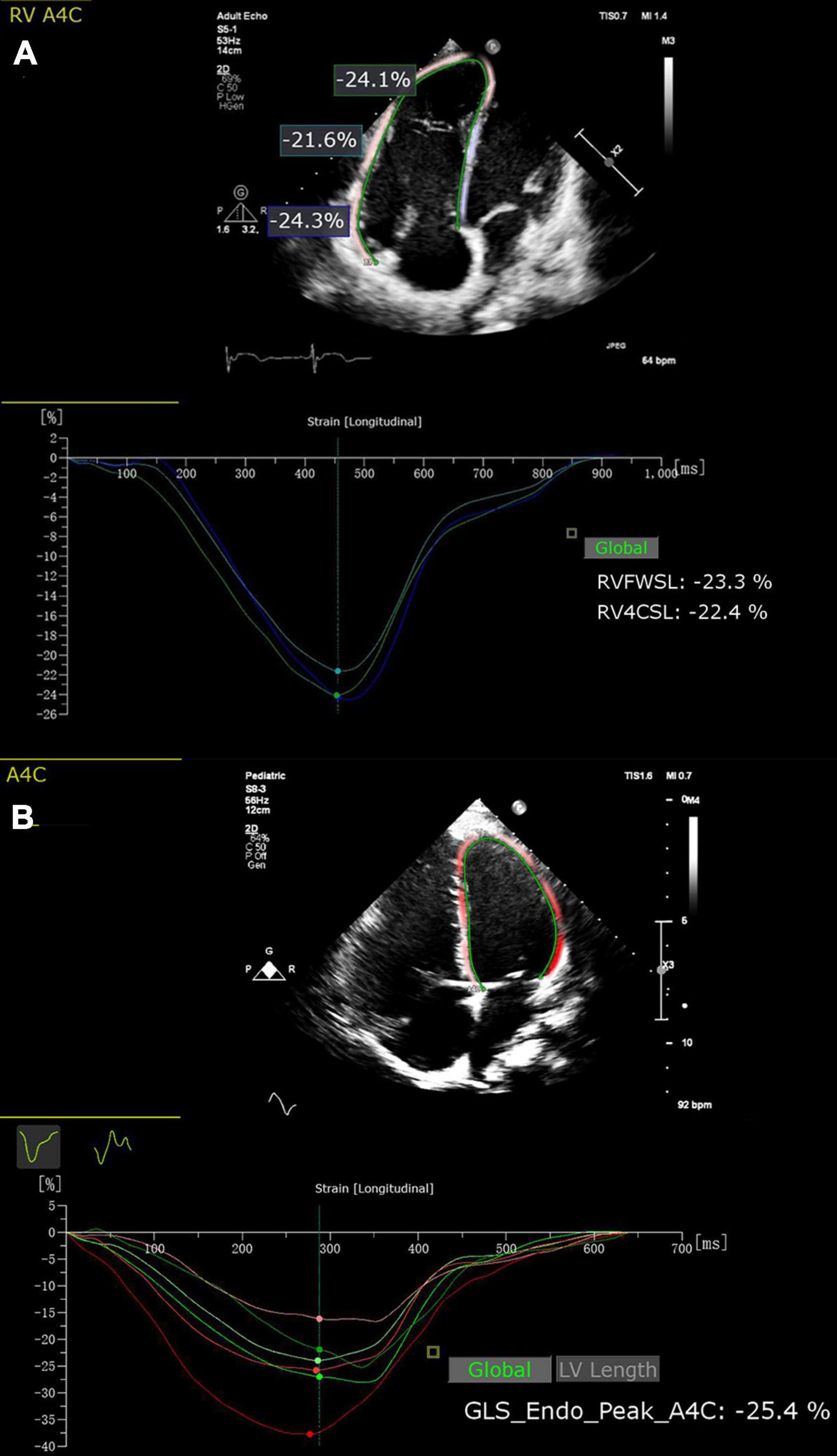 Role of strain echocardiography in patients with hypertension