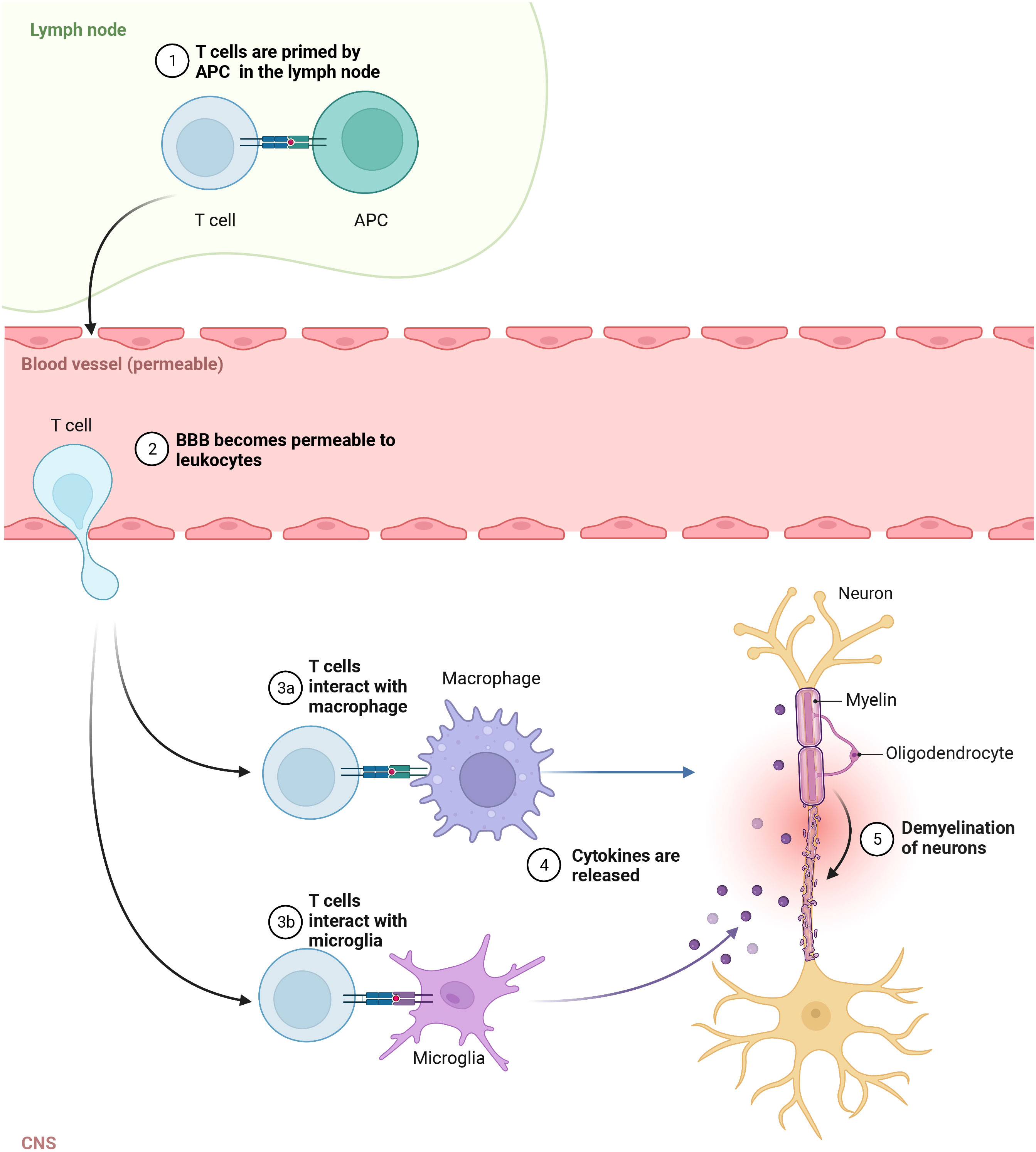 Frontiers  Therapeutic Advances in Multiple Sclerosis