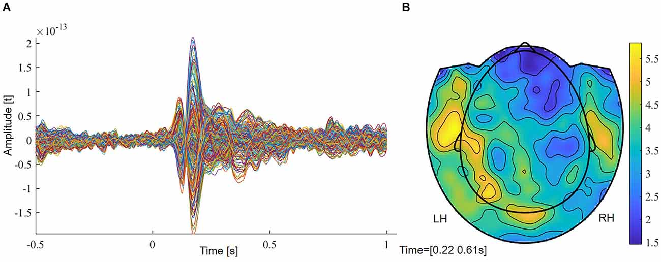 Channel spectra and map visualization of the beta band (13-30 Hz) of a