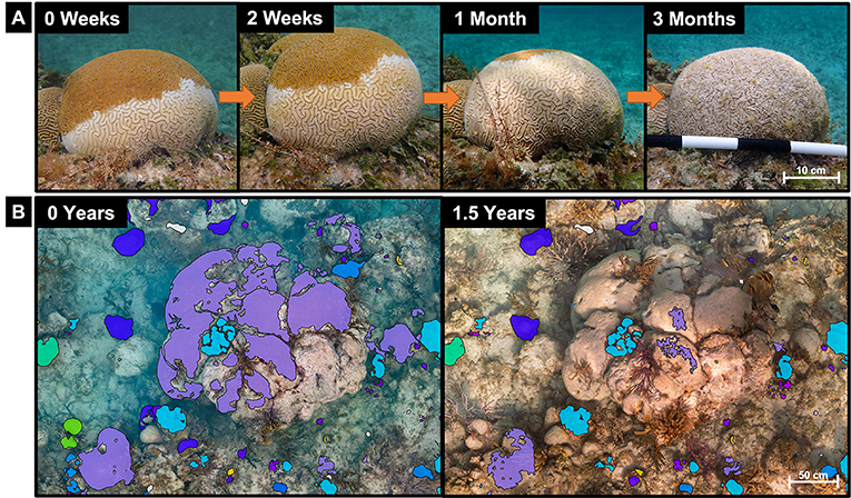 Figure 1 - (A) A colony of grooved brain coral (Diploria labyrinthiformis) infected with SCTLD.