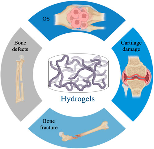 Self-powered implantable device stimulates fast bone healing, then