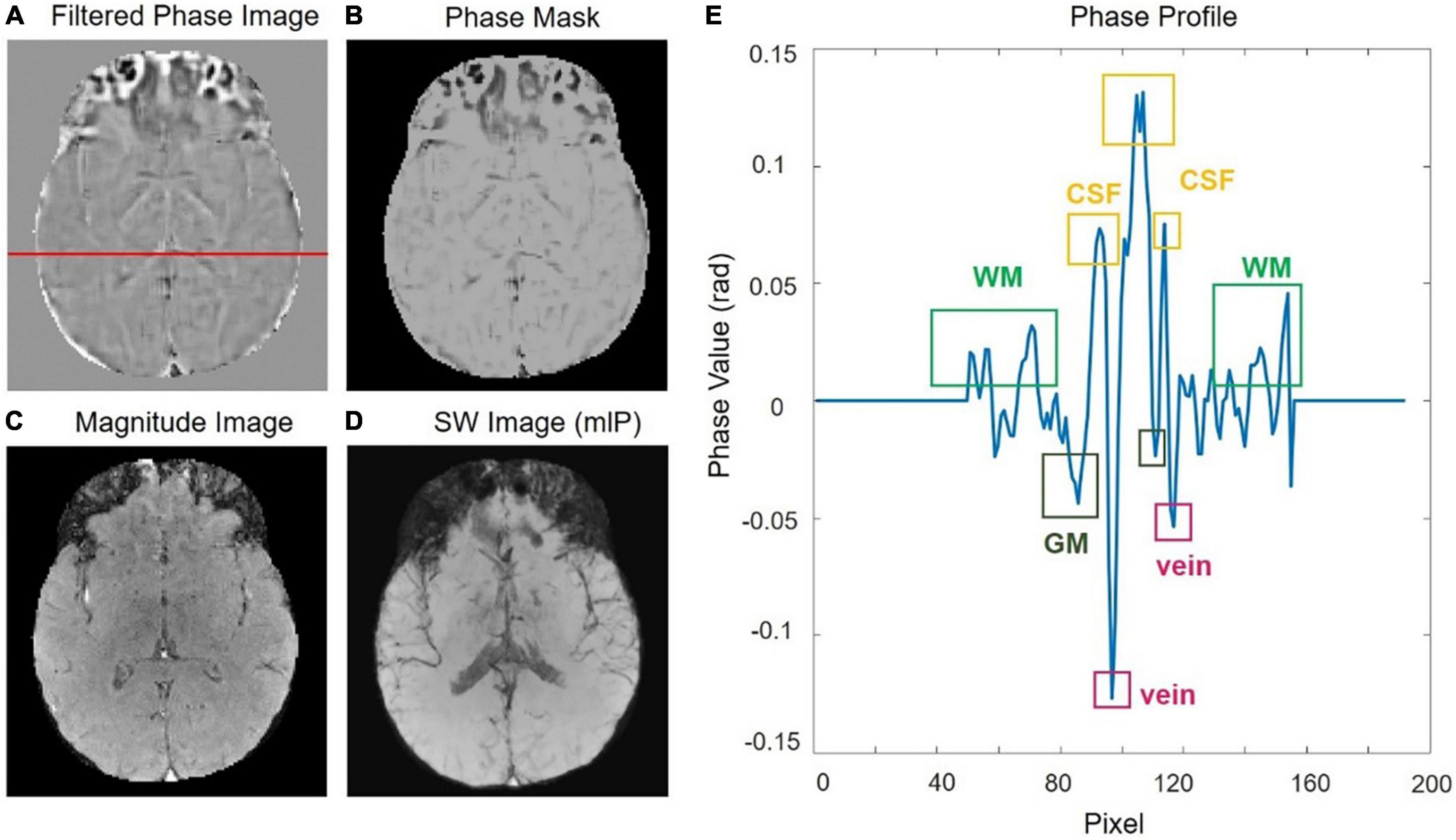 Journal of Magnetic Resonance Imaging: Vol 55, No 1