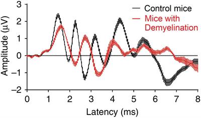 frequency theory of hearing