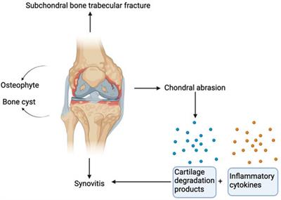 PDF) Excessive mechanical loading promotes osteoarthritis through