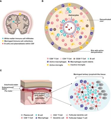 Frontiers  Therapeutic Advances in Multiple Sclerosis