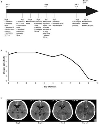 Frontiers | Devastating delayed cerebral ischemia after aneurysmal ...