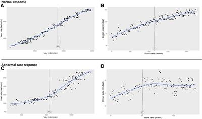 Frontiers  The utility of cardiopulmonary exercise testing in