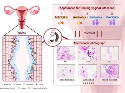 A prophylactic multi-strain probiotic treatment to reduce the