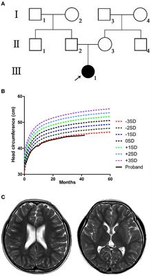 Cureus, Whole-Exome Sequencing Identified a Novel DYRK1A Variant in a  Patient With Intellectual Developmental Disorder, Autosomal Dominant 7