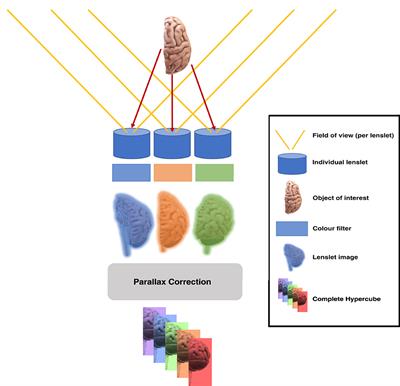Frontiers | Lightfield hyperspectral imaging in neuro-oncology surgery ...