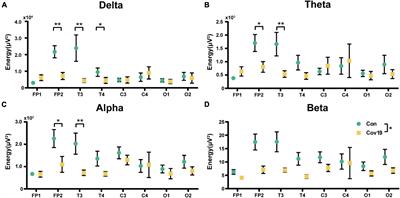 Study on brain damage patterns of COVID-19 patients based on EEG signals