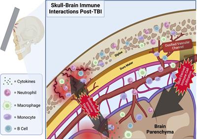 The emerging importance of skull-brain interactions in traumatic brain injury