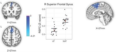 Examining putamen resting-state connectivity markers of suicide attempt history in depressed adolescents