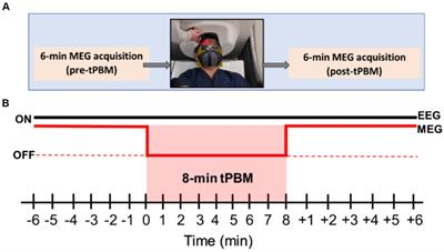 Simultaneous MEG and EEG Source Imaging of Electrophysiological Activity in response to Acute Transcranial Photobiomodulation