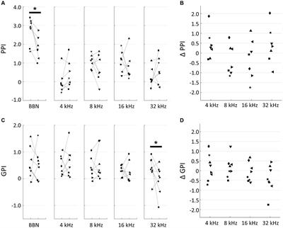Map plasticity following noise exposure in rat auditory cortex: Implications for disentangling neural correlates of tinnitus and hyperacusis