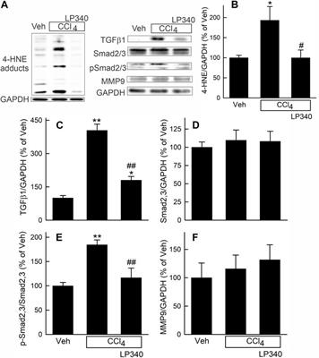 LP340, a novel histone deacetylase inhibitor, decreases liver injury and fibrosis in mice: role of oxidative stress and microRNA-23a