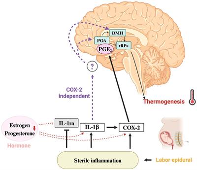 Fever in childbirth: A mini-review of epidural-related maternal fever