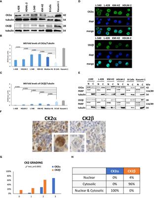 Frontiers | Protein kinase CK2α is overexpressed in classical hodgkin lymphoma, regulates key signaling pathways, PD-L1 and may represent a new target for therapy