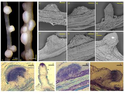 Frontiers A Developmental And Molecular View Of Formation Of Auxin Induced Nodule Like Structures In Land Plants Plant Science