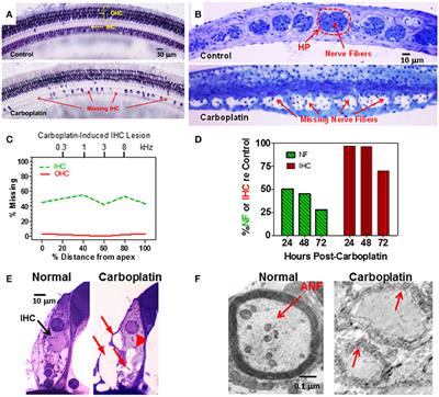 Frontiers Inner Hair Cell Loss Disrupts Hearing And - 