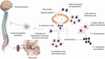 Bacterialis prostatitis chronica