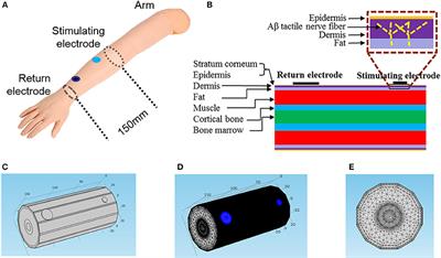 Targeted transcutaneous electrical nerve stimulation for phantom limb  sensory feedback