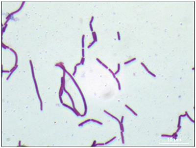 Frontiers | Lactobacillus paraplantarum 11-1 Isolated from Rice Bran  Pickles Activated Innate Immunity and Improved Survival in a Silkworm  Bacterial Infection Model