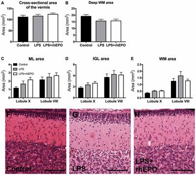 Kommuner hane Whitney Frontiers | Erythropoietin Protects Against Lipopolysaccharide-Induced  Microgliosis and Abnormal Granule Cell Development in the Ovine Fetal  Cerebellum