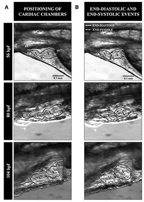 Frontiers Heart Performance Determination By Visualization - 