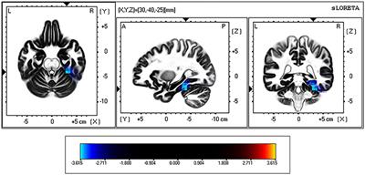 Frontiers The Brain Of Binge Drinkers At Rest Alterations In Theta And Beta Oscillations In First Year College Students With A Binge Drinking Pattern Frontiers The Brain Of Binge Drinkers At Rest Alterations In Theta And Beta Oscillations In First Year College Students With A Binge Drinking Pattern