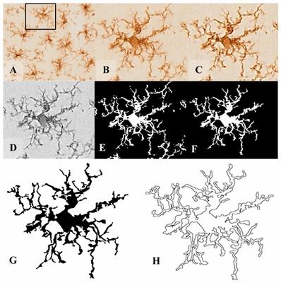 Types Of Email Accounts >> Frontiers | Microglia Morphological Categorization in a ... Types Of Email Accounts >> Frontiers | Microglia Morphological Categorization in a ...