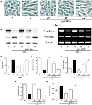 Fra-1/AP-1 induces EMT in mammary epithelial cells by modulating Zeb1/2 and  TGFβ expression