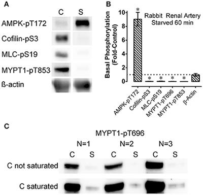 Frontiers Metabolic Stress Induced Activation Of Ampk And Inhibition Of Constitutive Phosphoproteins Controlling Smooth Muscle Contraction Evidence For Smooth Muscle Fatigue Physiology