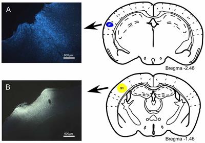 Frontiers | Bilateral Pathways from the Basal Forebrain to Sensory Cortices  May Contribute to Synchronous Sensory Processing