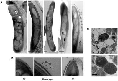 heroin raft Ruin Frontiers | Ultrastructural Analysis of Cell Envelope and Accumulation of Lipid Inclusions in Clinical Mycobacterium tuberculosis Isolates from Sputum, Oxidative Stress, and Iron Deficiency heroin raft Ruin Frontiers | Ultrastructural Analysis of Cell Envelope and Accumulation of Lipid Inclusions in Clinical Mycobacterium tuberculosis Isolates from Sputum, Oxidative Stress, and Iron Deficiency