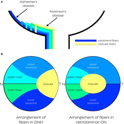 Frontiers Patterns Of Retinal Ganglion Cell Damage In Neurodegenerative Disorders Parvocellular Vs Magnocellular Degeneration In Optical Coherence Tomography Studies Neurology