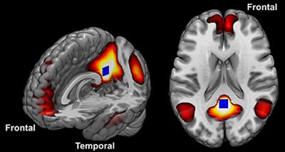 Frontiers | Differences in Cortical Structure and Functional MRI ...