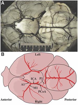 Frontiers Cerebral Artery Diameter In Inbred Mice Varies As A Function Of Strain Frontiers In Neuroanatomy